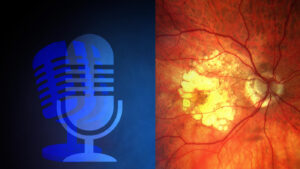 2 MACULOPATIA ESSUDATIVA