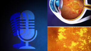 edema macu diabetico